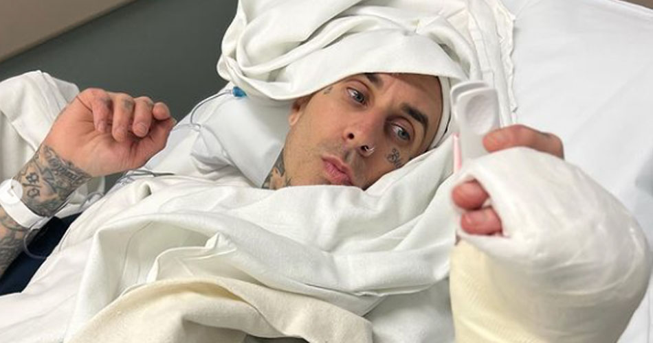 Travis Barker compartilha vídeo e fotos de cirurgia que “foi um sucesso”